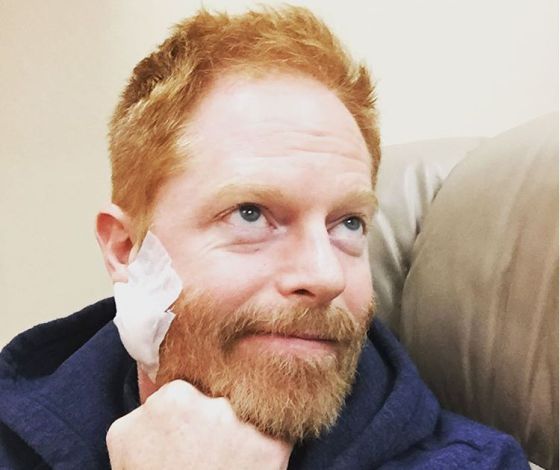 Jesse Tyler Ferguson es operado de cáncer de piel